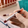 Coronavirus, test sierologici negativi per operatori ambulanti di Bisceglie