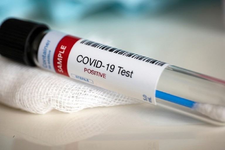 Tampone analisi Coronavirus